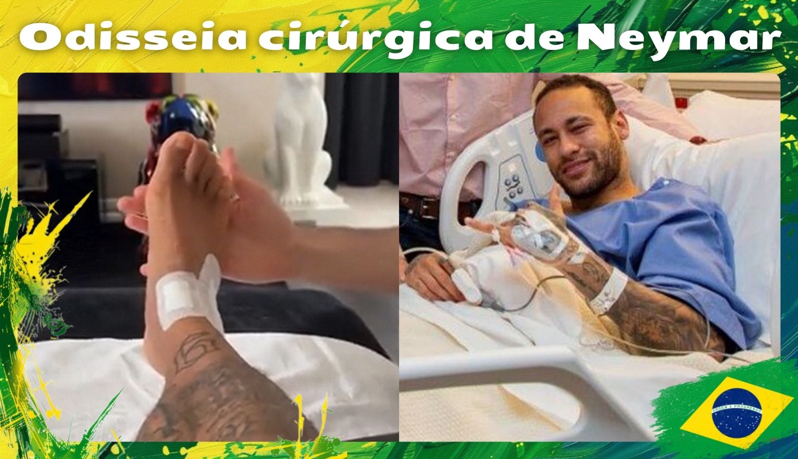 Odisseia cirúrgica de Neymar Notícias esportivas no Brasil